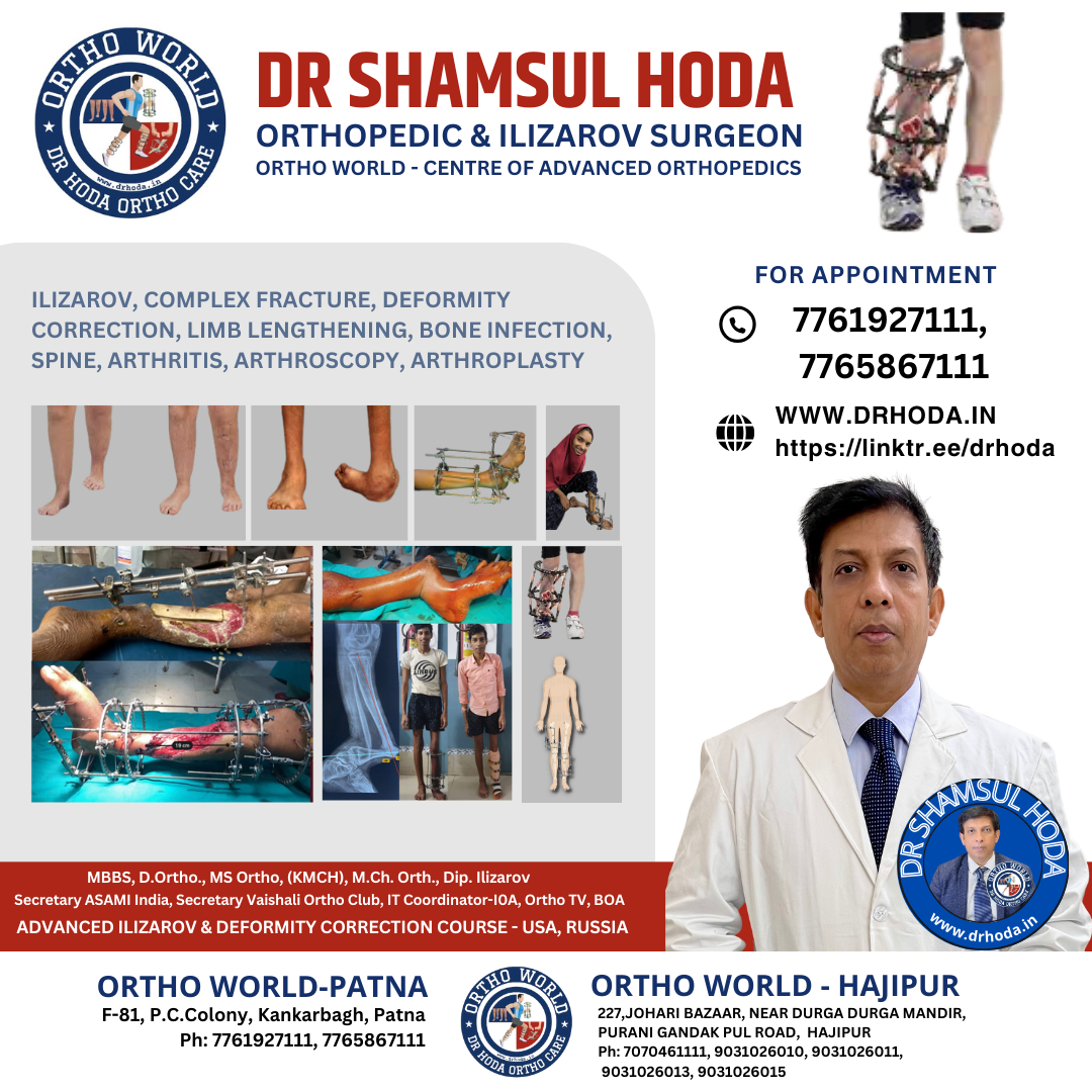 Ilizarov Surgery Deformity Correction & Limb Lengthening