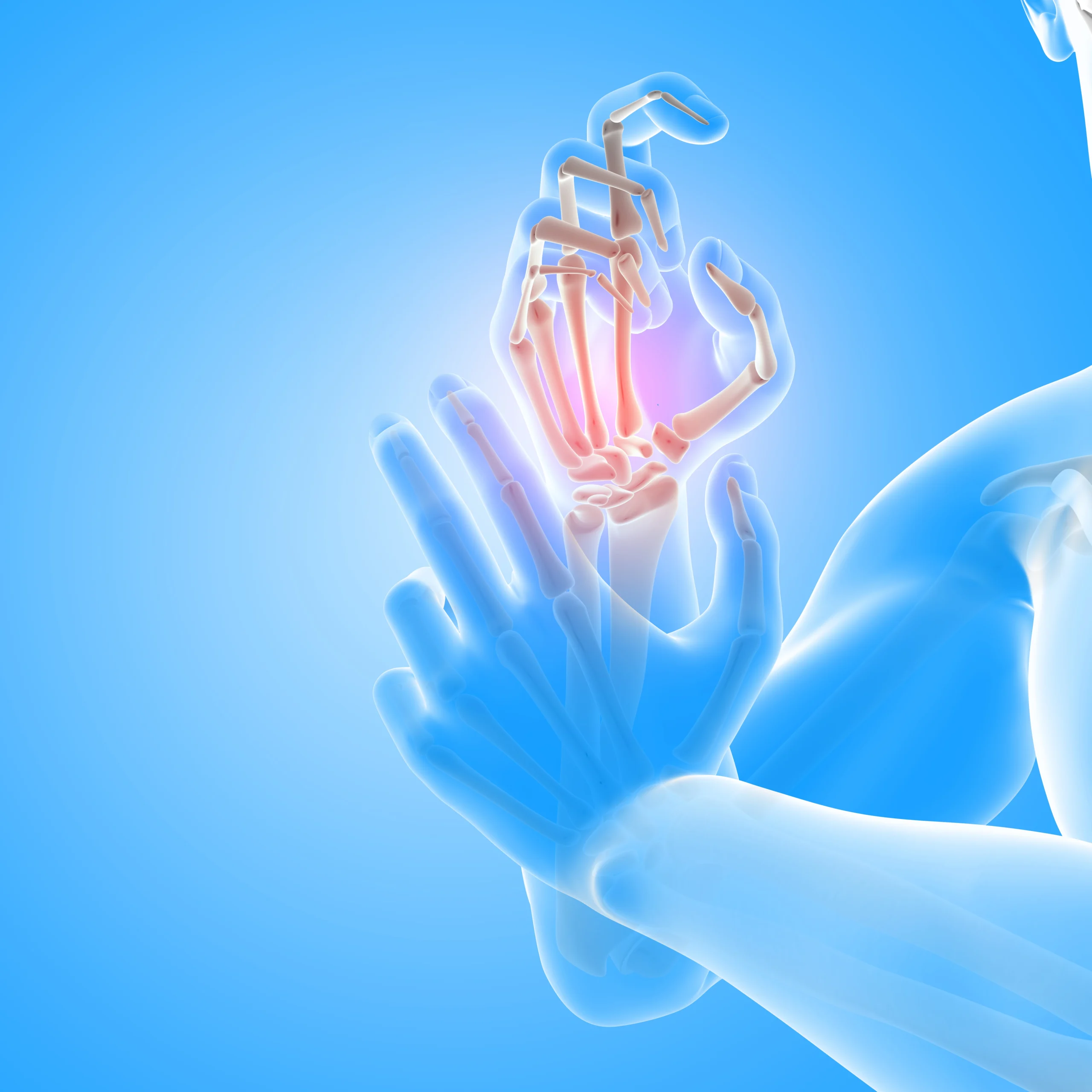 Arthritis Rheumatology & Joint Replacement1